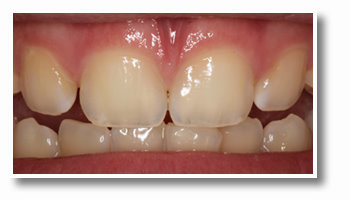 beautiful teeth dont touch them